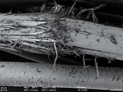 A damaged hair follicle.