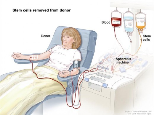 stemcelldonor_14261