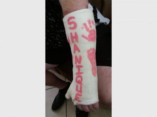 JAN's daughter's name on his cast with her hand and footprint.