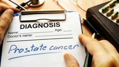 47BEGCNKETBFEA_78762