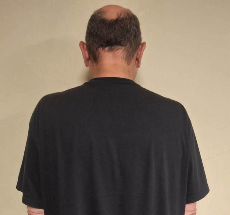 Rear view of a balding man in an oversized black T-shirt and dark shorts, standing against a plain beige wall in a neutral, subdued setting.