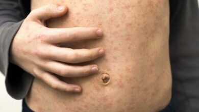 sick-child-body-sto_32406