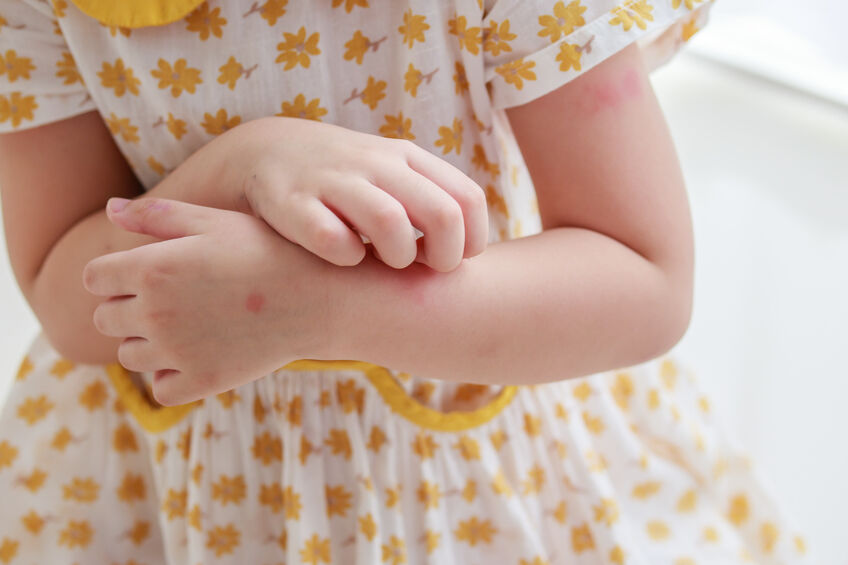 How to treat your child's skin rash