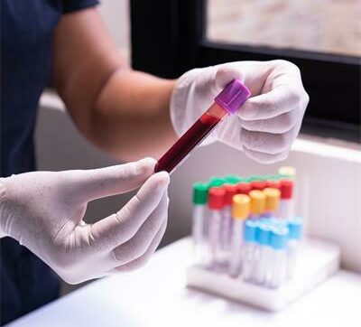 pexels-los-muertos-_32226