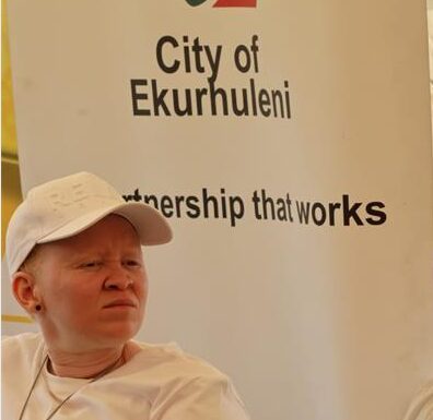 The Katlehong event focused on breaking stigma, promoting education and supporting people living with albinism.
