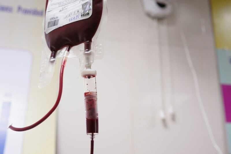 Blood in a packet hanging from something.