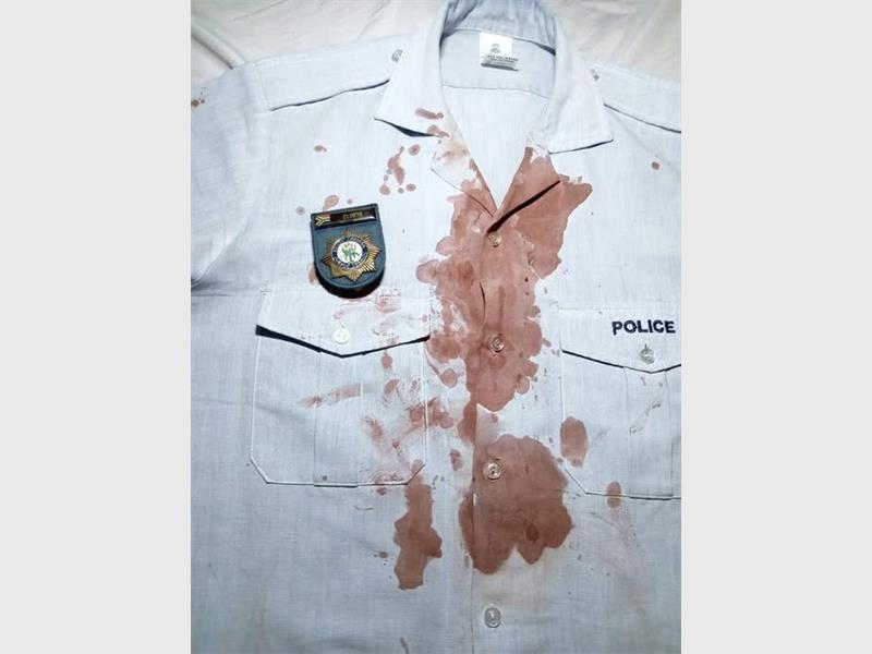 After surviving a brutal stabbing, a South African police officer’s heartfelt message lays bare the emotional and physical toll of life on the front lines.