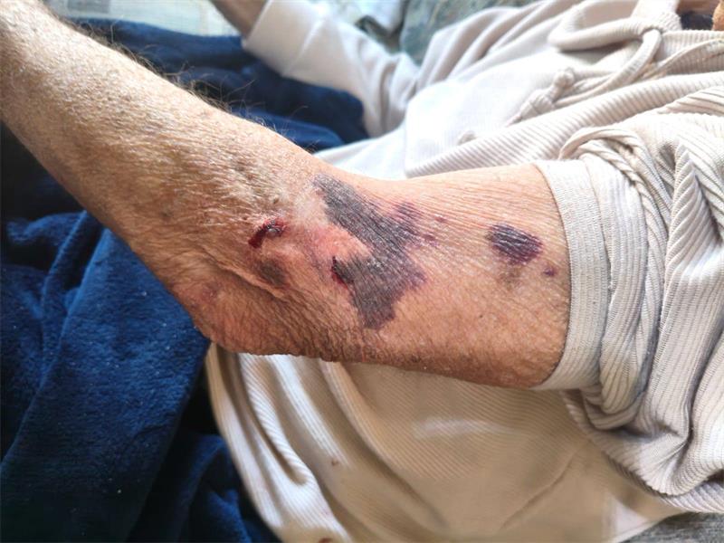Residents at Annie Burger Retirement Village say criminals and drug users are entering the property freely, with elderly pensioners allegedly being threatened, robbed and intimidated.