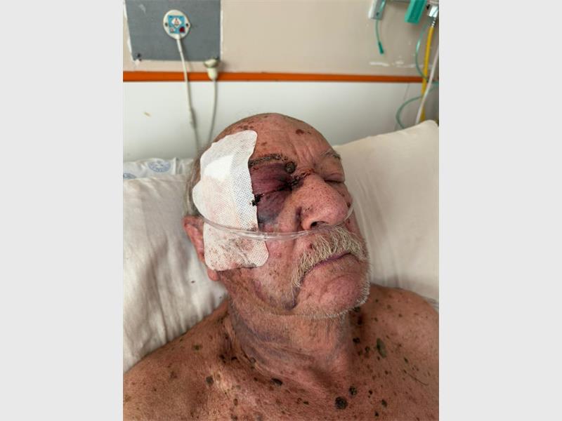 An elderly Rosettenville couple endured a violent home invasion that left both seriously injured, with the husband later dying from his wounds weeks after the attack.
