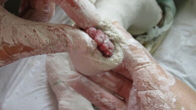 Cast2_22817_tn