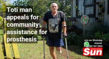 A man with crutches and an amputated left leg.