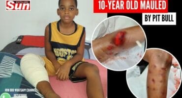 Victim of pit bull attack, Che’dyn Ogle sitting on a bed with a bandaged leg. Two circles displaying injuries of the child.