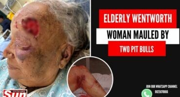 Open wound on victim Delyse Augustine’s head as well as scarring on her leg.