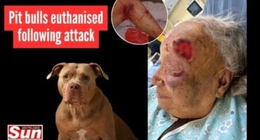 Elderly woman with severe head wound and bite marks to her leg after pit bull attack.