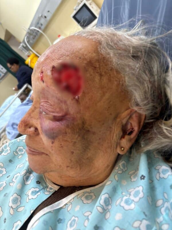 Open wound on victim Delyse Augustine’s head.