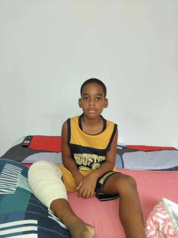 An injured Che’dyn Ogle sitting on his bed with a bandaged leg.
