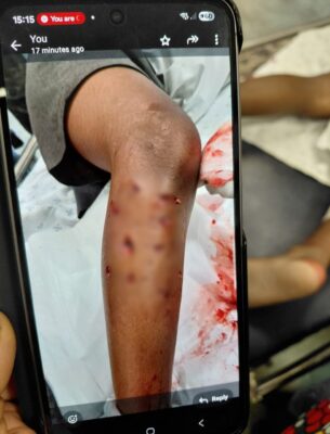 Picture of the phone showing a blurred injury to the leg.
