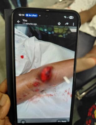 Picture of the phone showing a blurred injury to the calf.