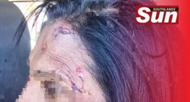 The Merebank woman sustained serious facial injuries.