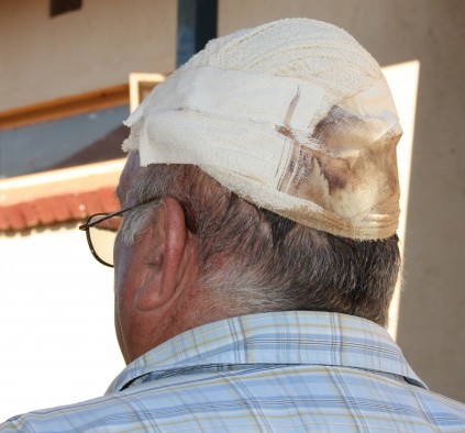 Mnr. Gerhard Coetzee is erg aangerand.
