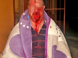 barberton plaasaanval