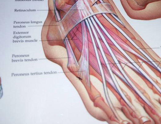 Die tendon heel links op die foto, is ontsteek in my voet. 