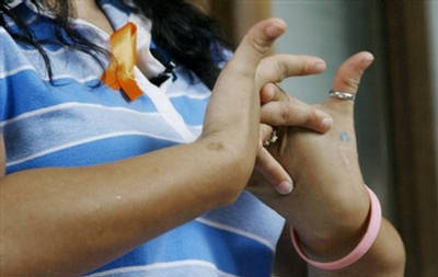Fidgeting fingers? Be very wary! (Photo: shoroftheday.com)