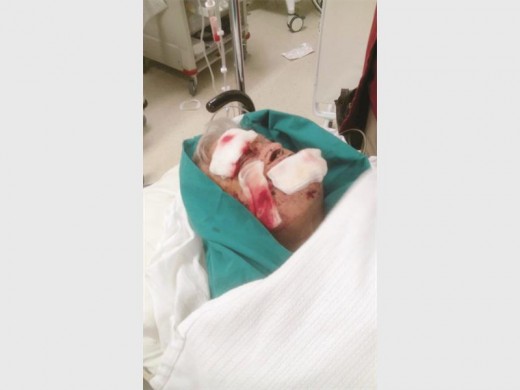 Mr Robert Paterson after the surgery.