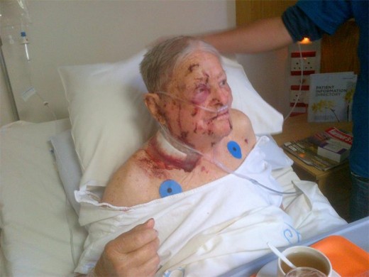Paterson after the surgery.