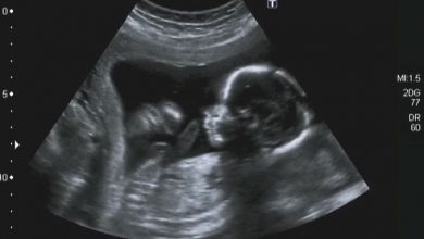 Can an ultrasound at birth reveal autism risk?