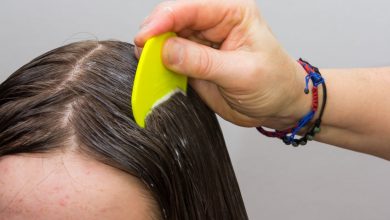 Lice: Signs, treatments, and how it’s spread