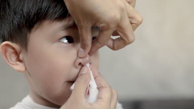 All about nosebleeds in children