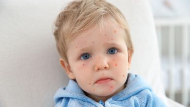 The ins and outs of chickenpox: When your tot has a spot