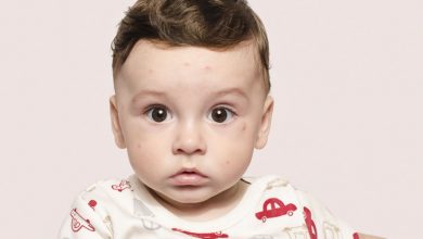 Baby measles: What’s that spot you’ve got?