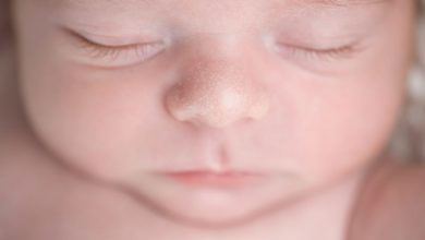 Milia in babies: What is it and how can you treat it?