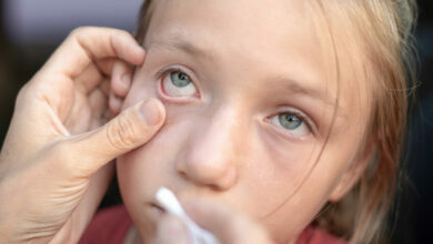 Help: My child has something stuck in their eye!