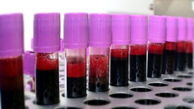 blood-3996485_960_720