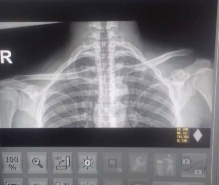 Survivor of an execution-style shooting Tshepo Ramoepane shares the harrowing details of his shooting.