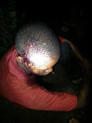 The teen had sustained serious wounds to the head, as the community took matters into their won hands.