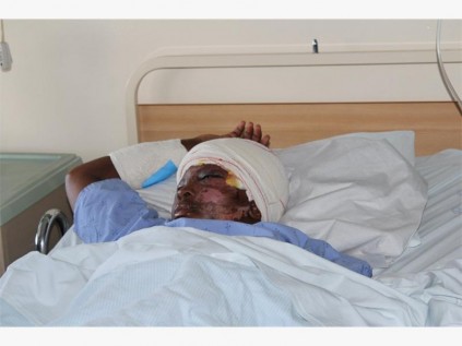Nomthandazo Cele (20) was one of the most critically injured in the bus accident that claimed the lives of eight maidens and two guardians. She is however, recovering well in Port Shepstone Regional Hospital.