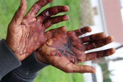 hands