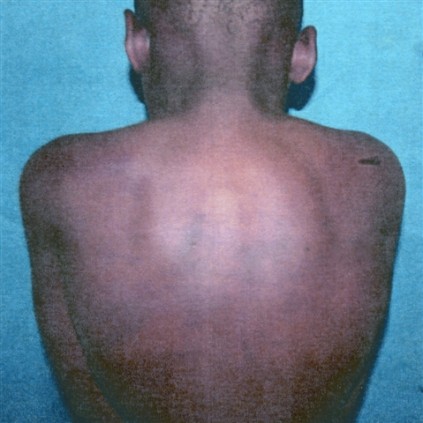 This child (12) was beaten by four police officers.