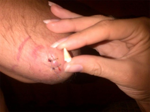 What will the African tooth fairy pay for this?