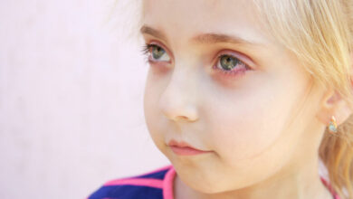 Conjunctivitis: Does my child have pinkeye?