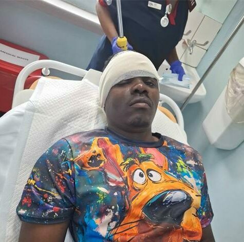 A violent dog attack left a Midrand SPCA worker seriously injured, serving as a stark reminder of the dangers faced by these heroes for animals and people everyday.