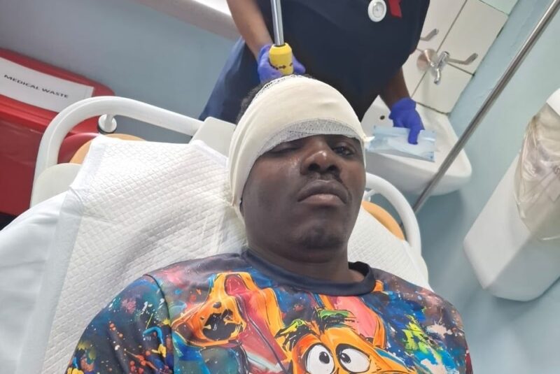 While carrying out his daily duties at the Midrand SPCA, Daniel Musuko never expected his routine shift to end in hospital when a violent dog attack left him with facial injuries.