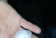 Photo of hail in Glencoe in a person's hand.