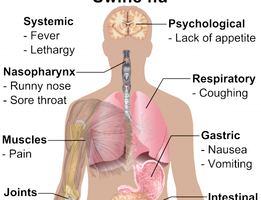 Symptoms_of_swine_flu