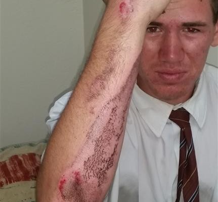 A Gr 11 learner of Tom Naudé Technical High School, Fanie Nel, was involved in a hit and run accident on Monday, 30 January.
