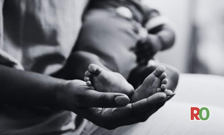 One conjoined twin dies after separation surgery in Mankweng